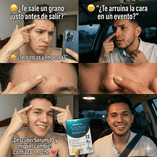 🔥 Desinflama ese grano en una sola noche y recupera tu confianza 😱
