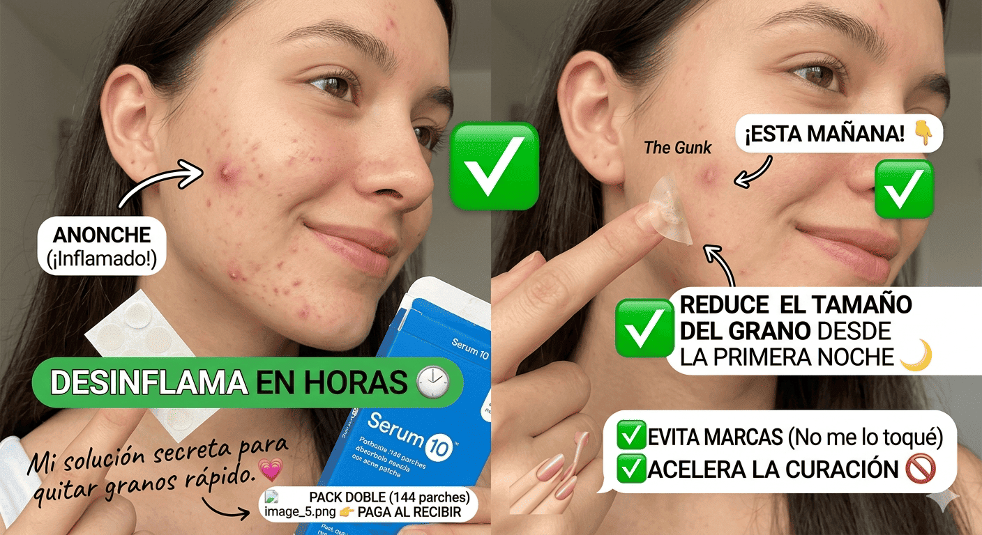 🔥 Desinflama ese grano en una sola noche y recupera tu confianza 😱